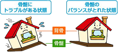 骨盤のゆがみを家に例えているイラスト